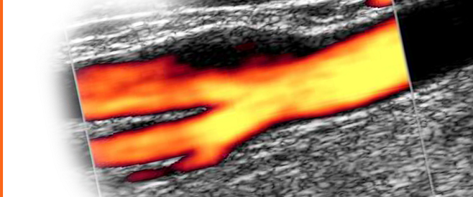 Vascular Ultrasound: An Interactive Review 2024 Banner