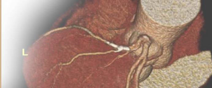 Cardiac CTA: An Interactive Review 2024 Banner